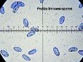 Legaliana limnaea-amf89-spores